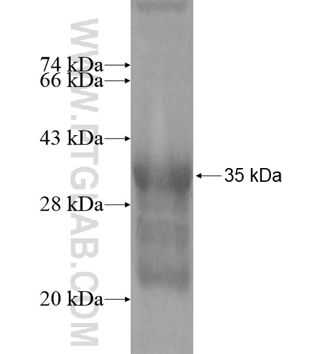 EFNA4 fusion protein Ag15664 SDS-PAGE EFNA4 fusion protein Ag15664 SDS-PAGE