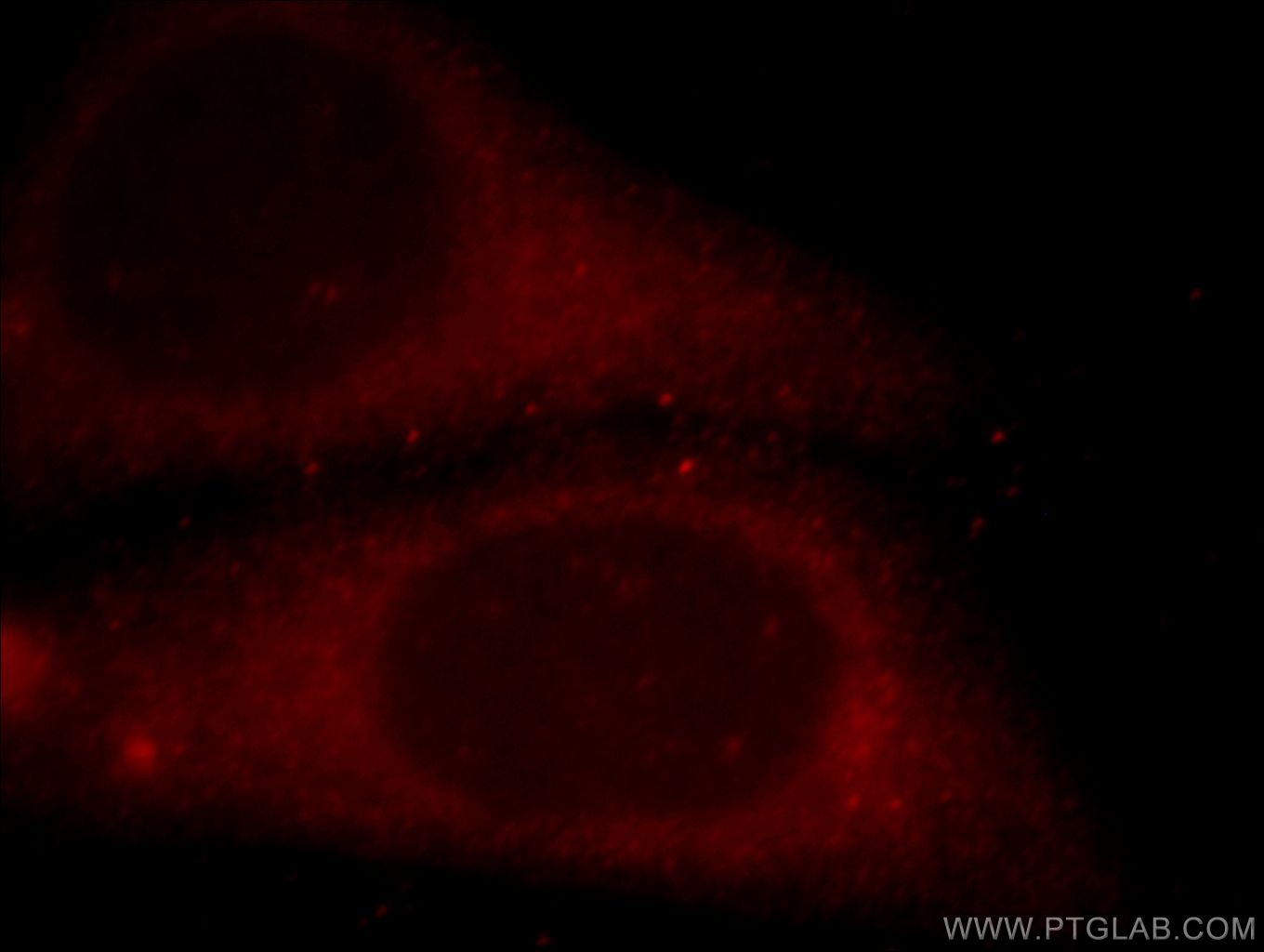 IF Staining of HepG2 using 20538-1-AP