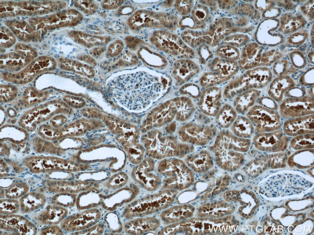 IHC staining of human kidney using 24729-1-AP