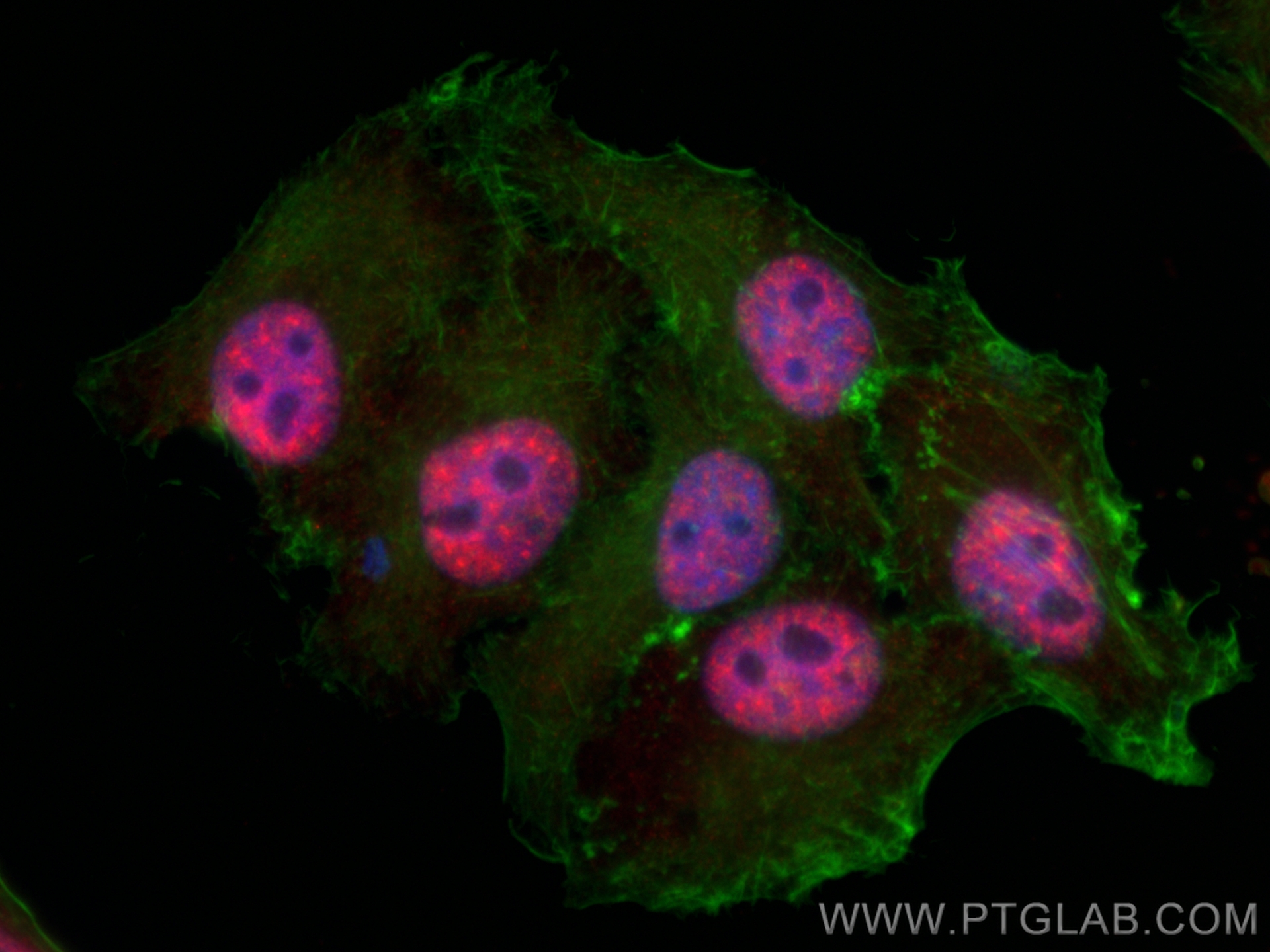 IF Staining of HepG2 using 10208-1-AP
