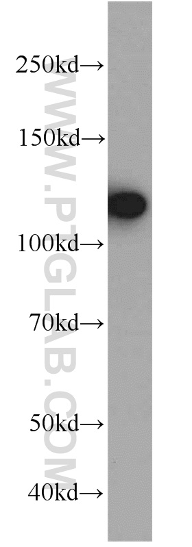 WB analysis of HeLa using 10208-1-AP