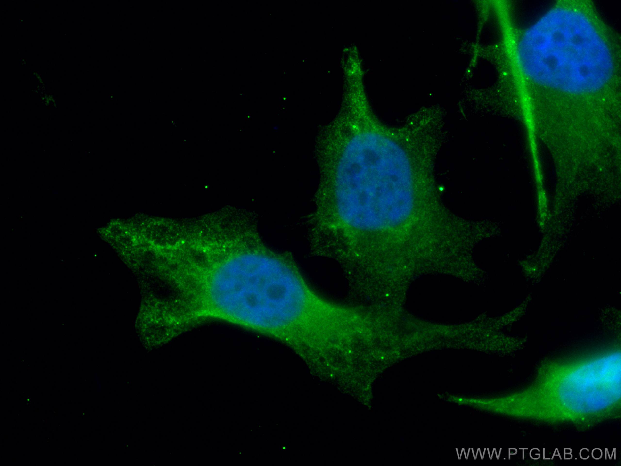 IF Staining of HeLa using 67855-1-Ig (same clone as 67855-1-PBS)
