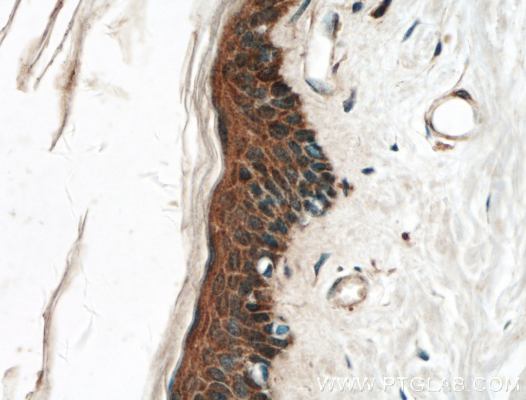 IHC staining of human skin using 27141-1-AP