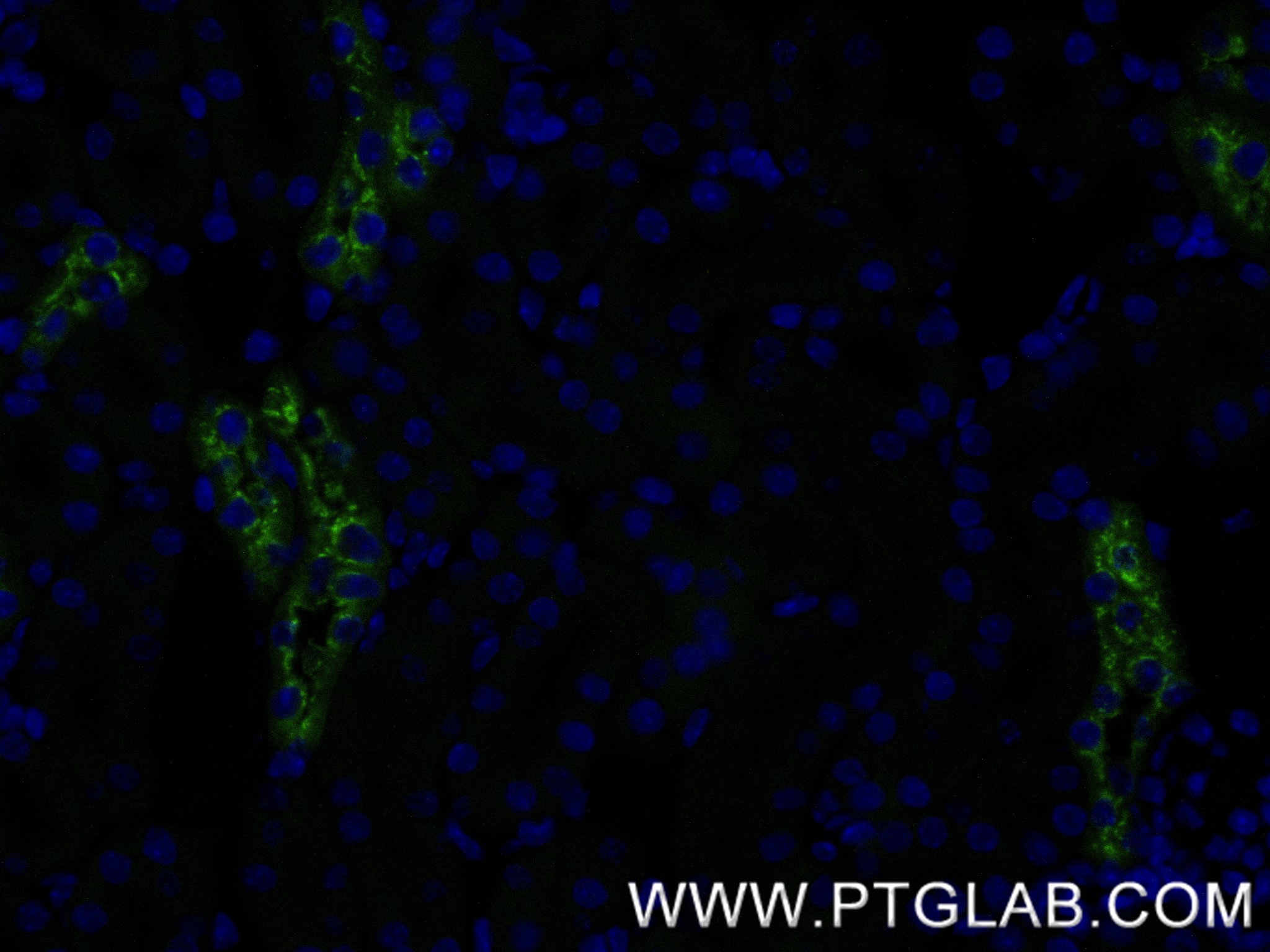 IF Staining of mouse kidney using 84601-1-RR (same clone as 84601-1-PBS)
