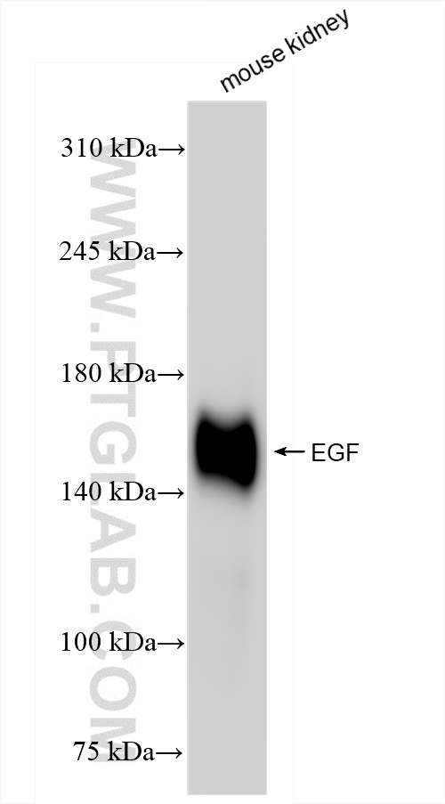 WB analysis of mouse kidney using 84601-1-RR (same clone as 84601-1-PBS)