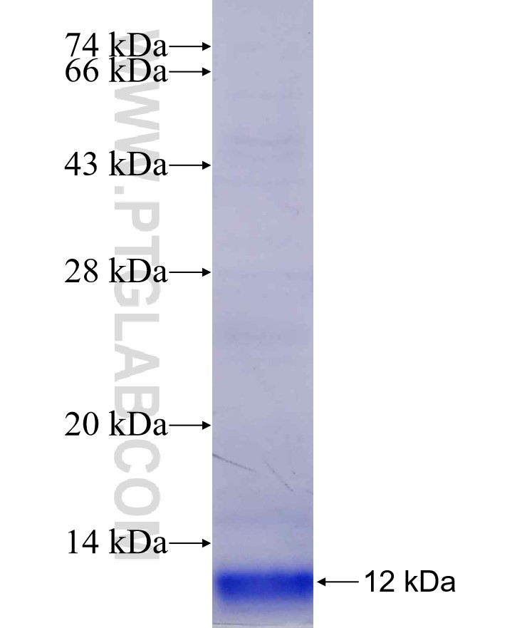 EGF fusion protein Ag29114 SDS-PAGE EGF fusion protein Ag29114 SDS-PAGE