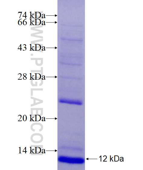 EGF fusion protein Ag17658 SDS-PAGE EGF fusion protein Ag17658 SDS-PAGE