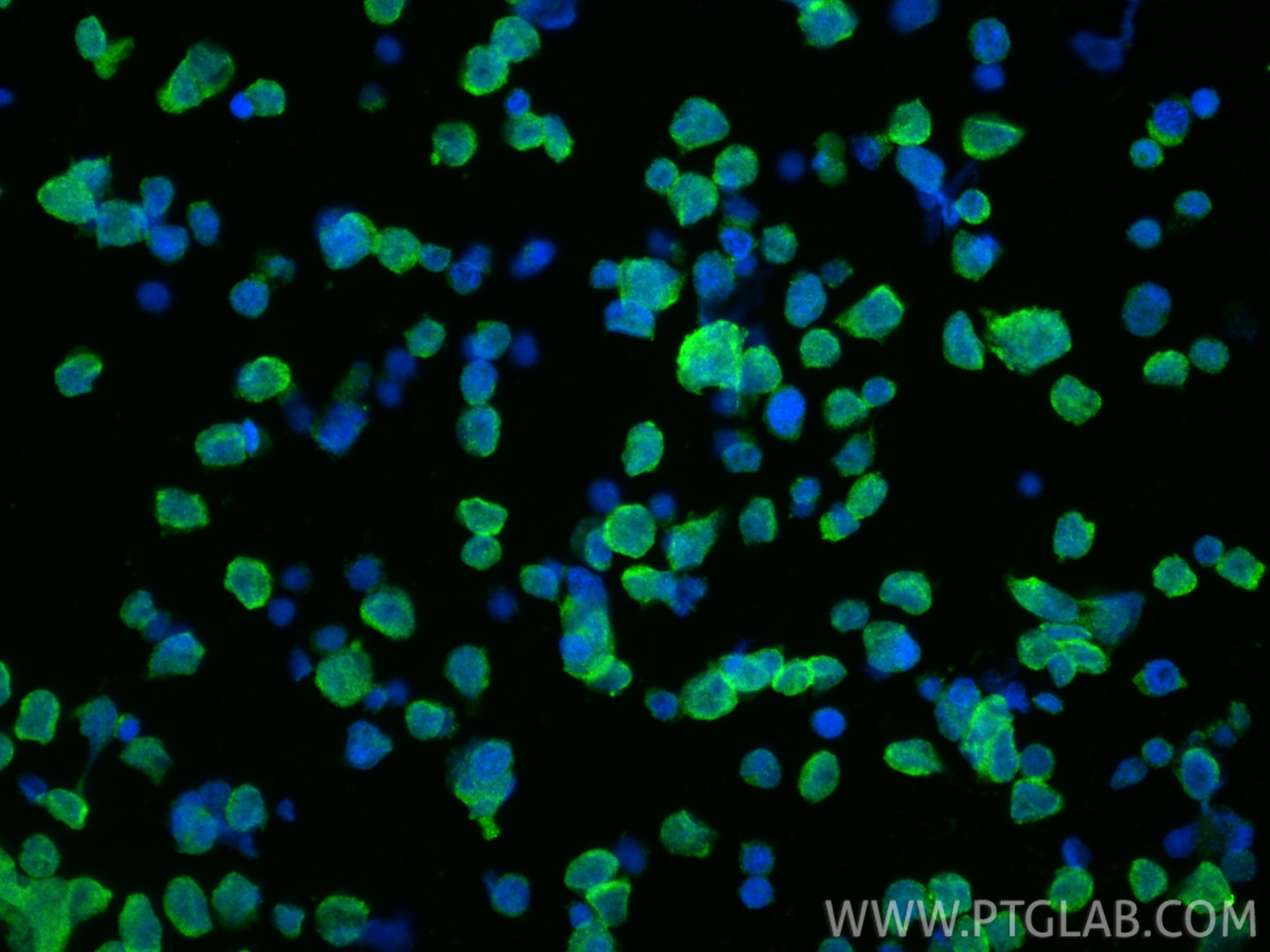 IF Staining of Y79 using 14578-1-AP