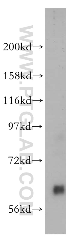 WB analysis of human placenta using 14578-1-AP