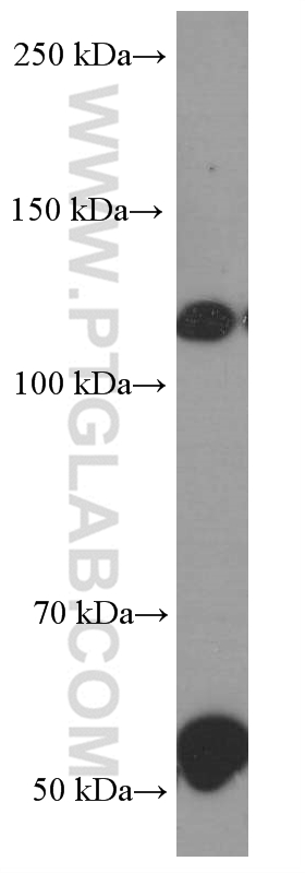 WB analysis of human retina using 66232-1-Ig