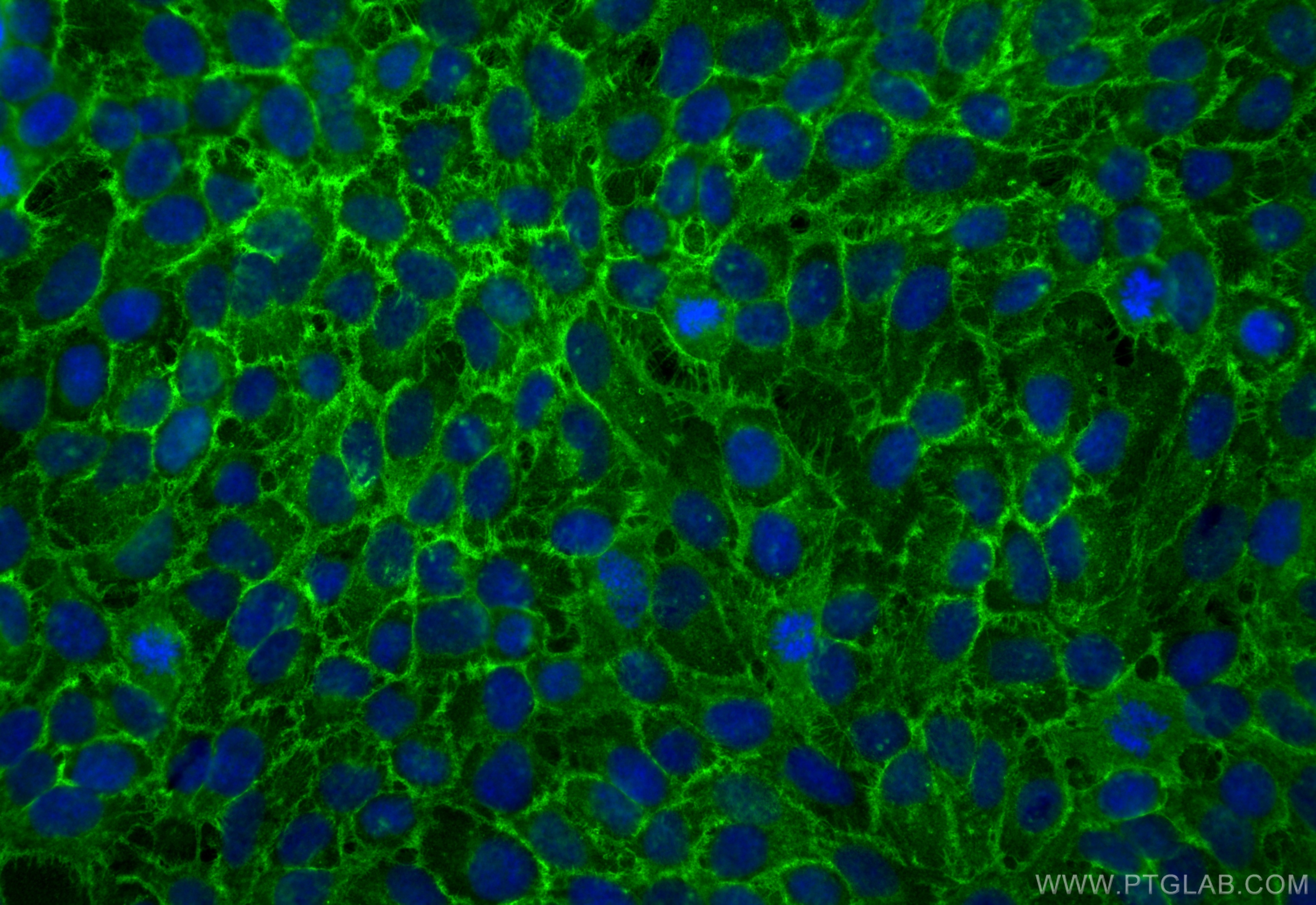 IF Staining of HaCaT using 30139-1-AP