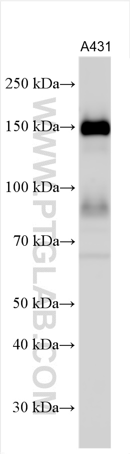 WB analysis using 30139-1-AP