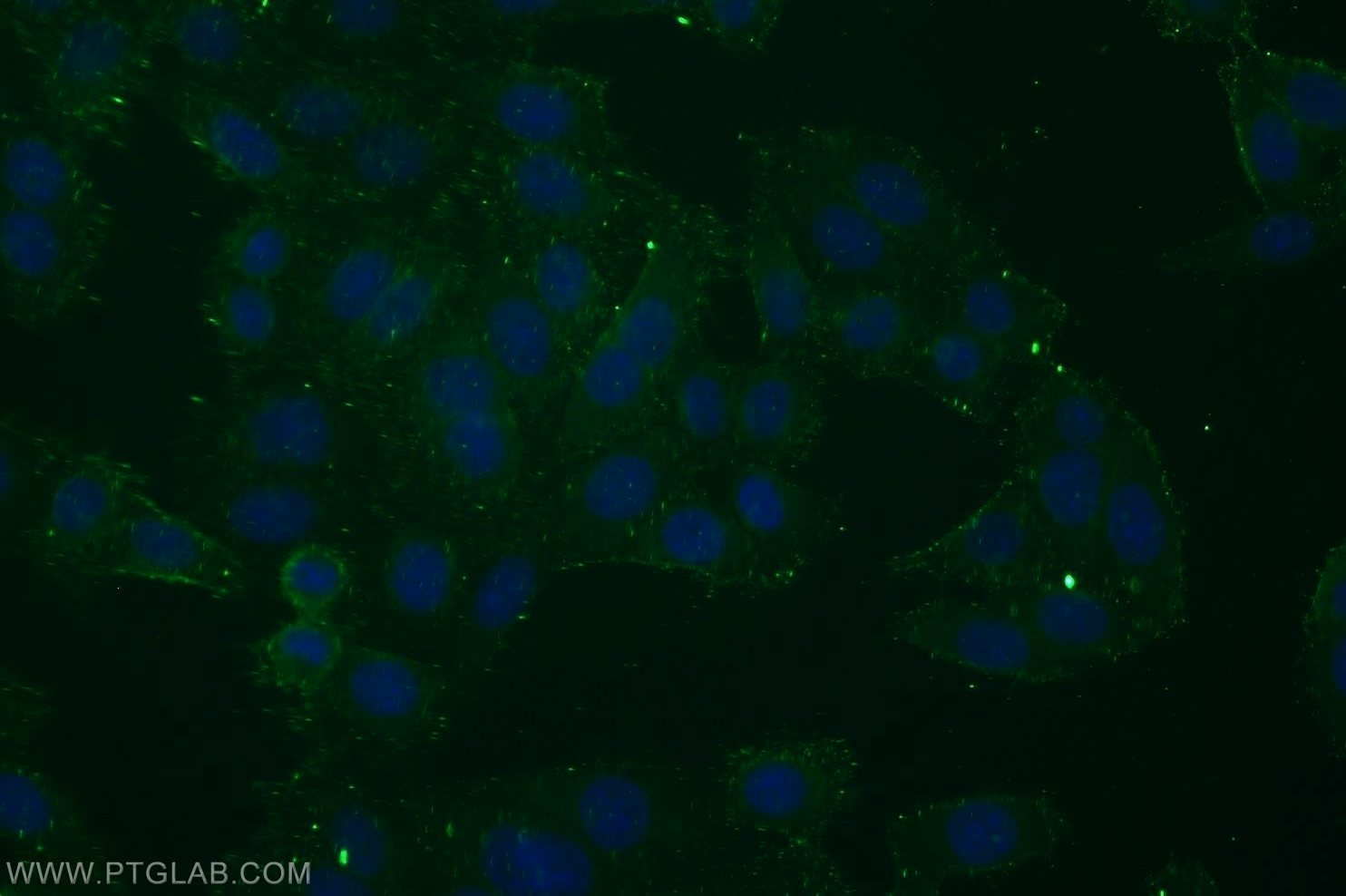 EGFR (C-terminal)