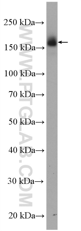 WB analysis of A431 using 51071-2-AP