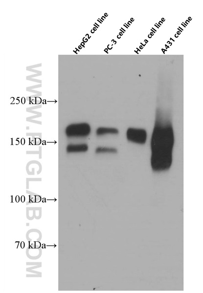 EGFR Monoclonal antibody