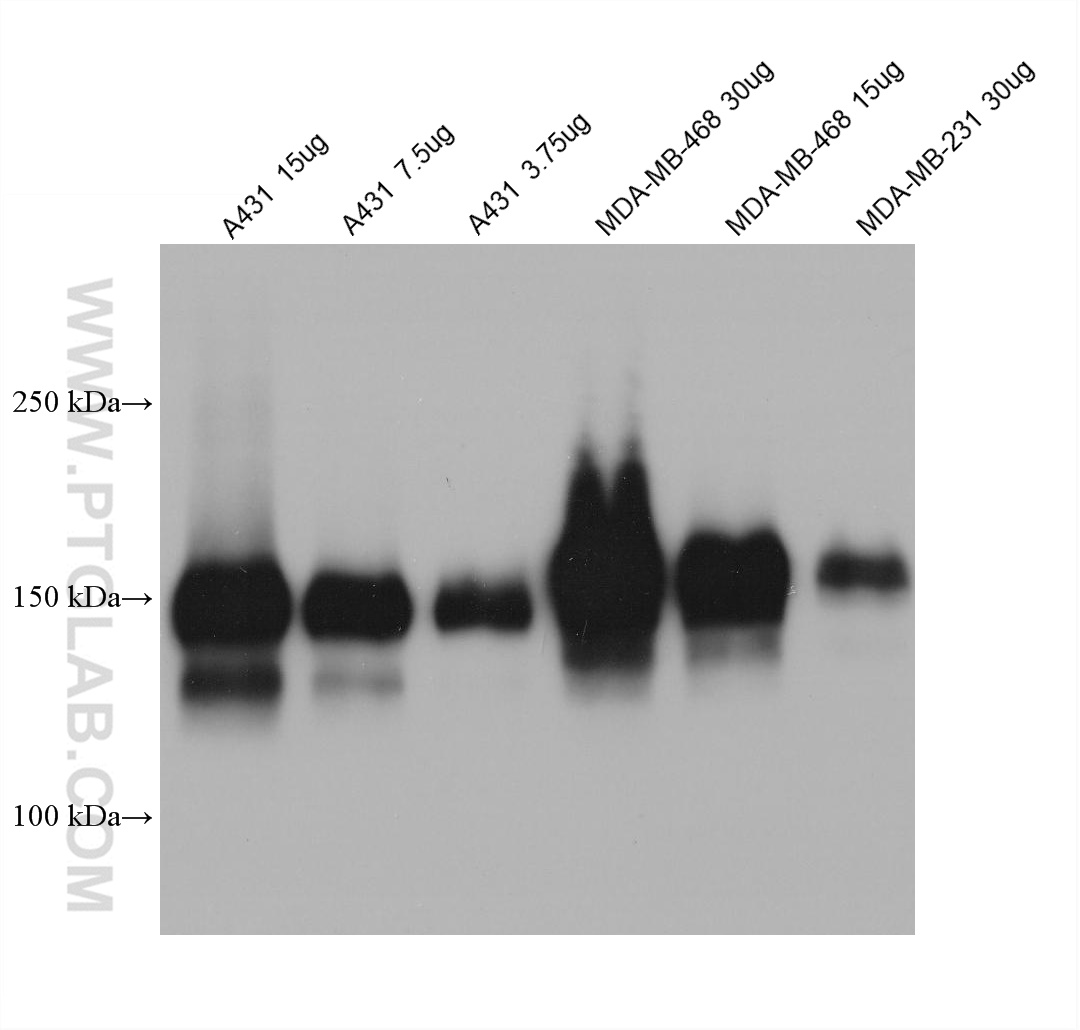 WB analysis using 66455-1-Ig (same clone as 66455-1-PBS)