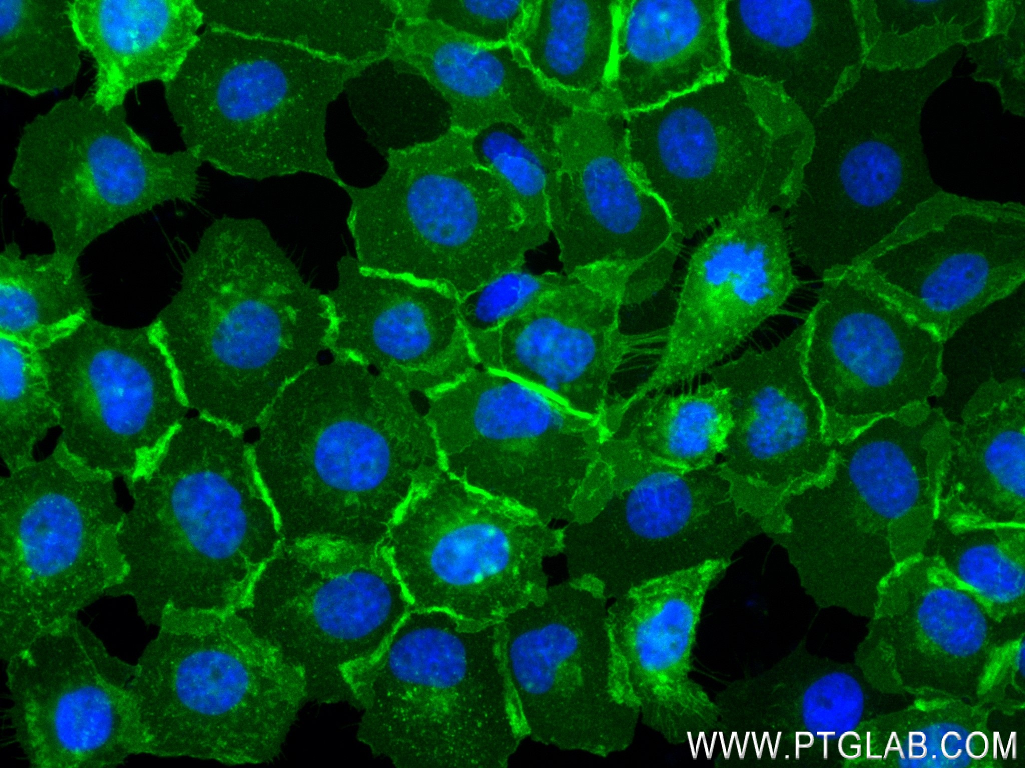 IF Staining of A431 using 83806-1-RR
