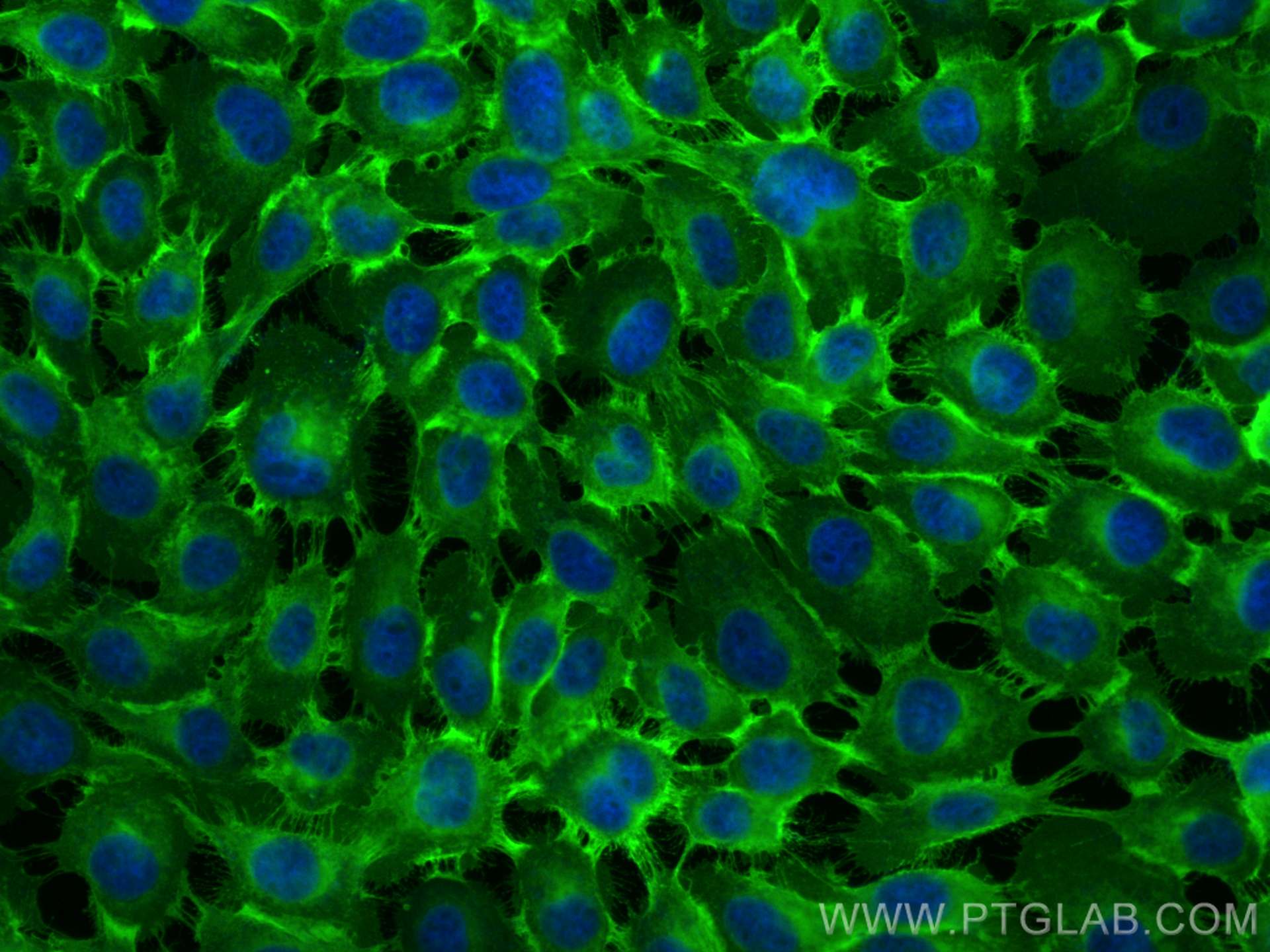 IF Staining of A431 using CL488-30139