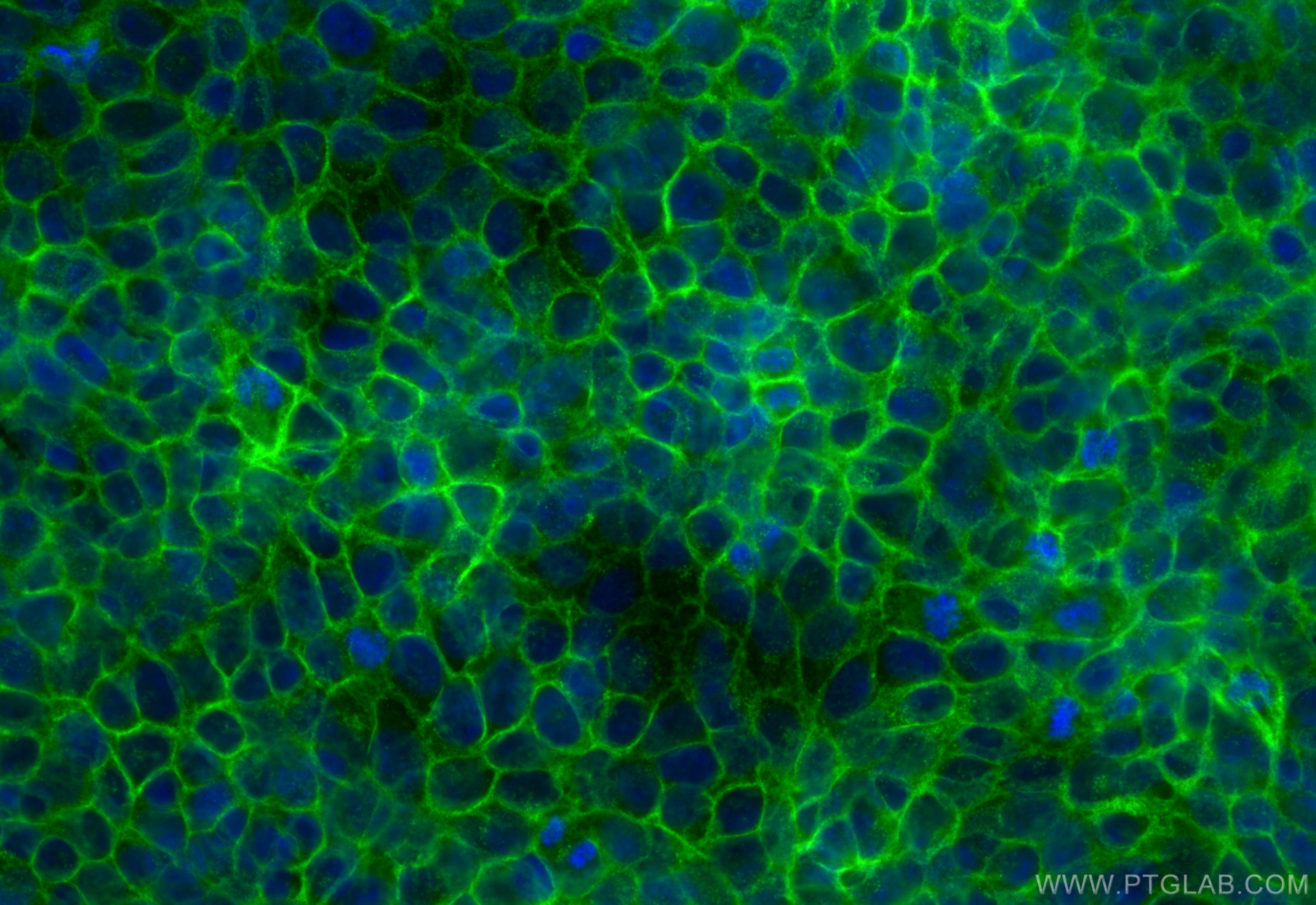 IF Staining of HaCaT using CL488-30139
