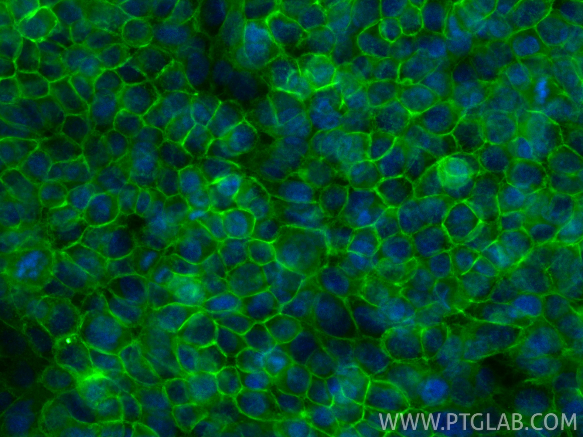 IF Staining of A431 using CL488-83806