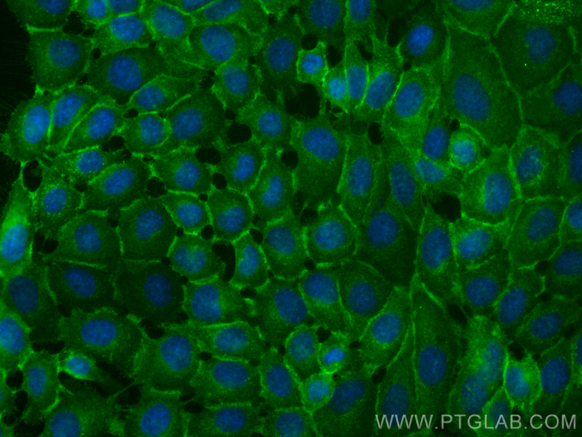 IF Staining of A431 using CL488-51071