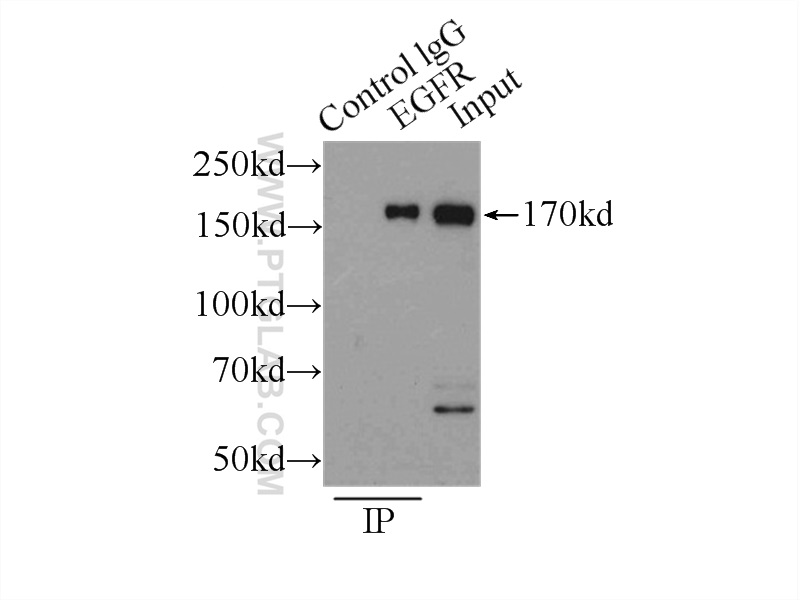 EGFR-Specific Polyclonal antibody