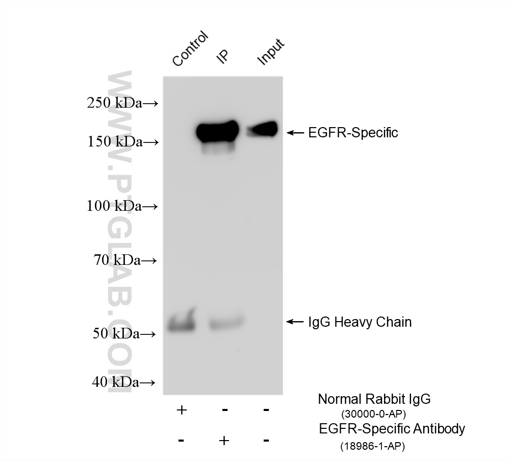 IP experiment of L02 using 18986-1-AP