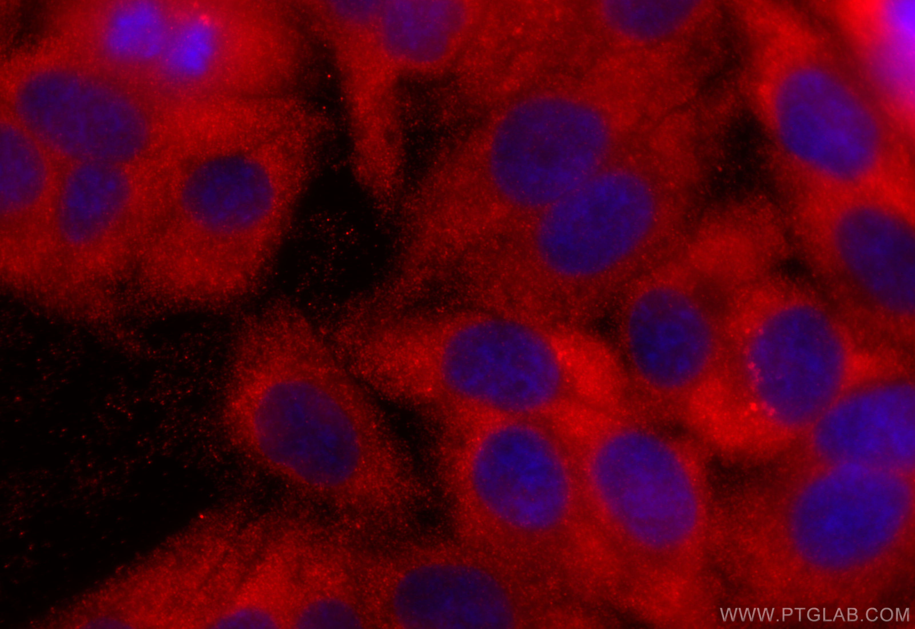 IF Staining of HepG2 using 20368-1-AP
