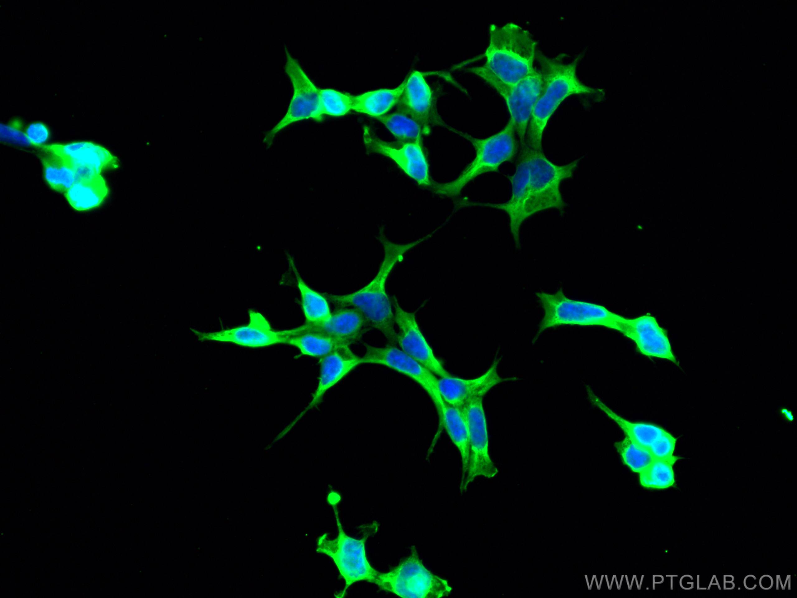 PHD2/EGLN1