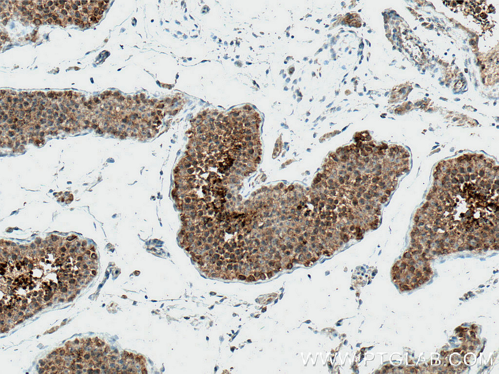 IHC staining of human testis using 66589-1-Ig (same clone as 66589-1-PBS)