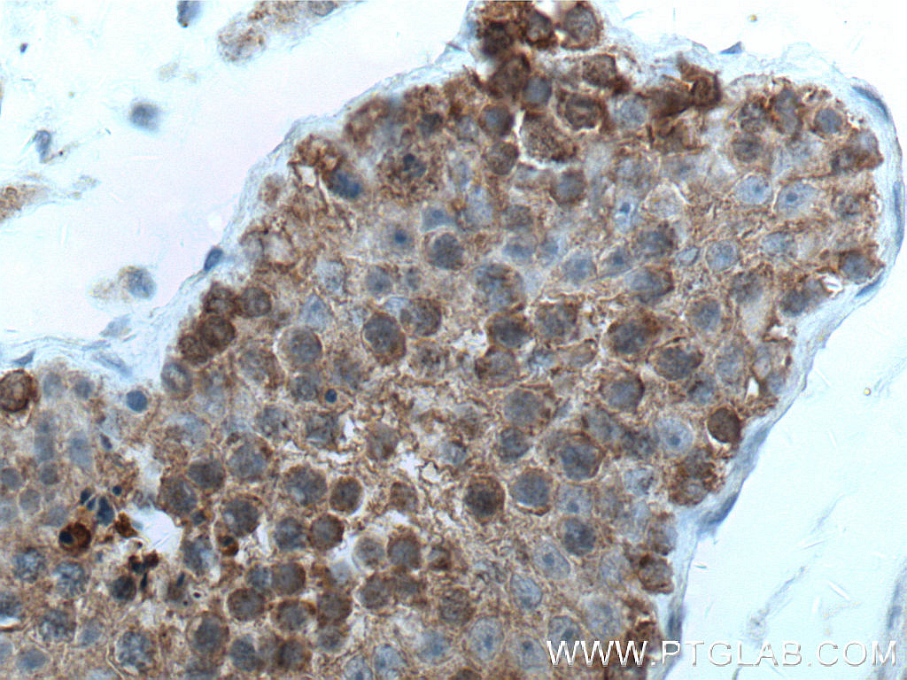 IHC staining of human testis using 66589-1-Ig (same clone as 66589-1-PBS)