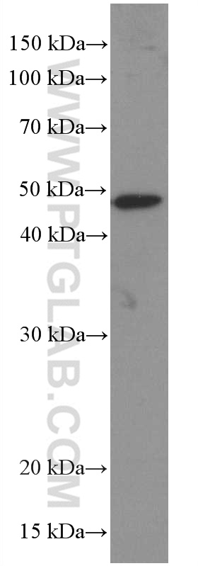 WB analysis of mouse brain using 66589-1-Ig