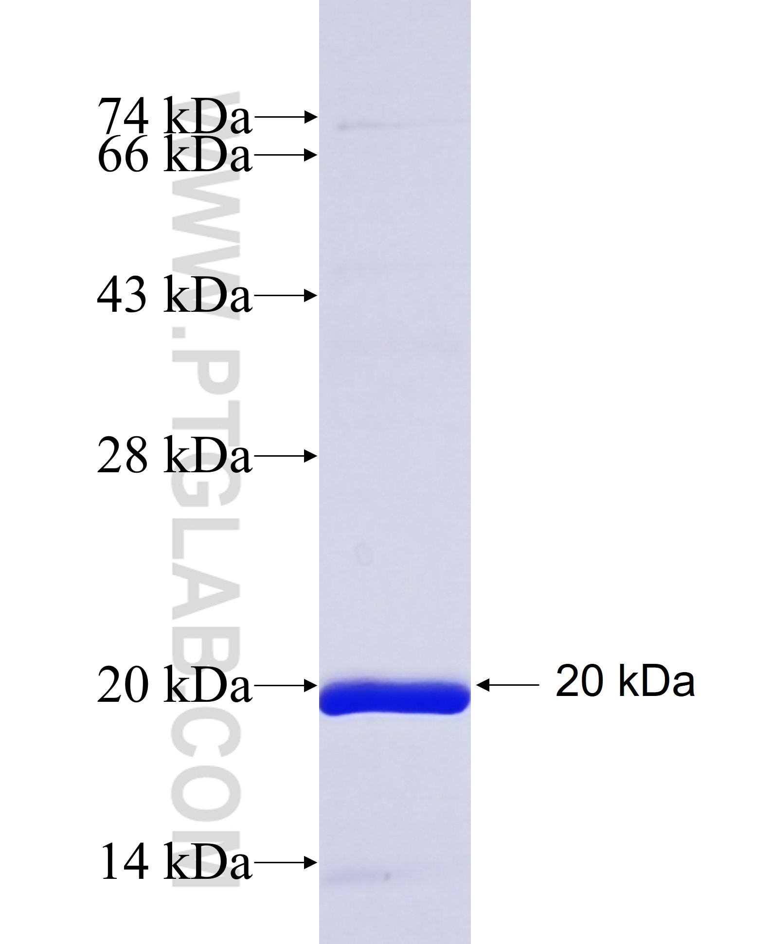 EGLN1 fusion protein Ag13714 SDS-PAGE EGLN1 fusion protein Ag13714 SDS-PAGE