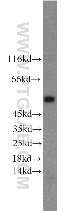 PHD1 Polyclonal antibody