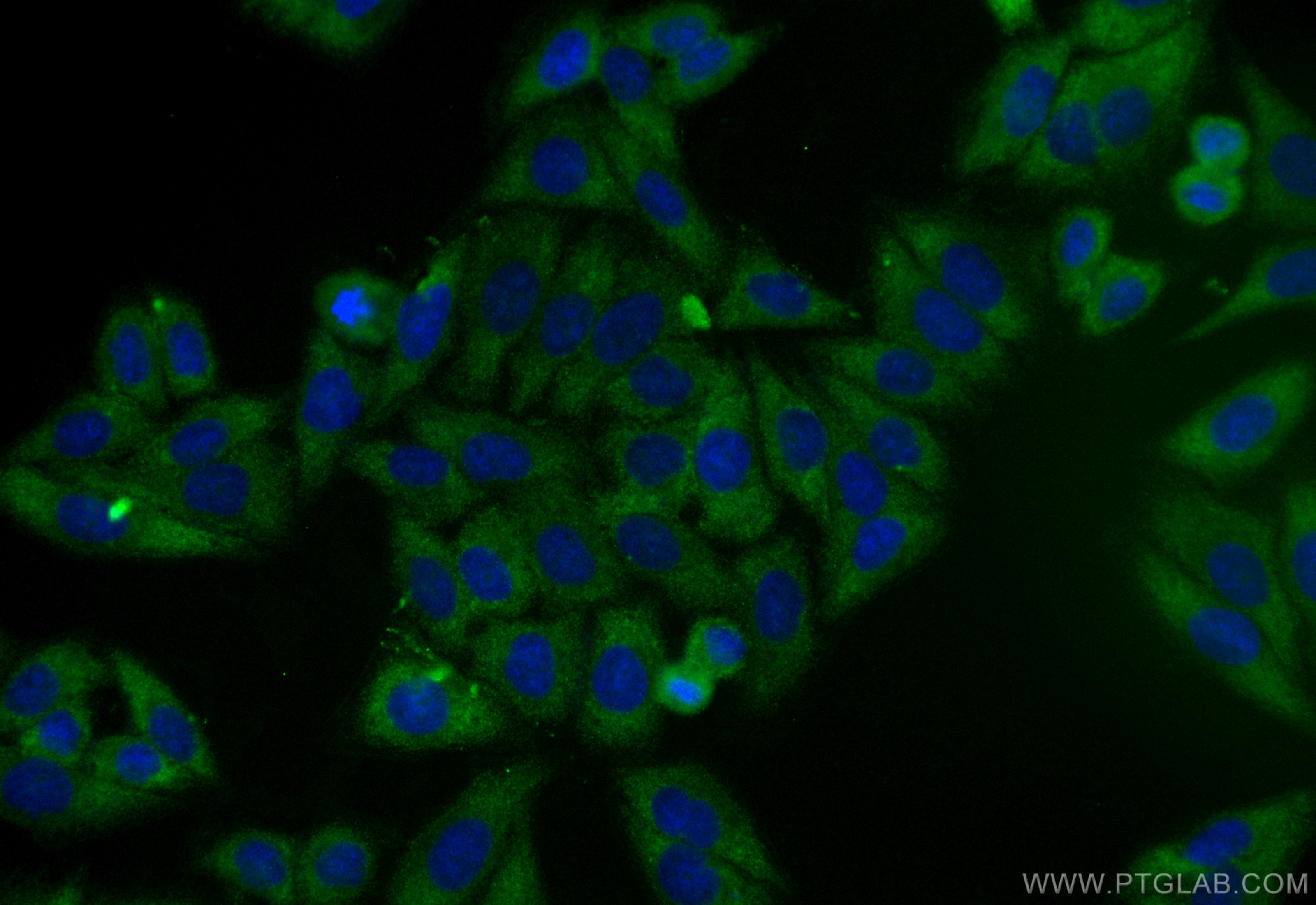 IF Staining of HepG2 using CL488-83321