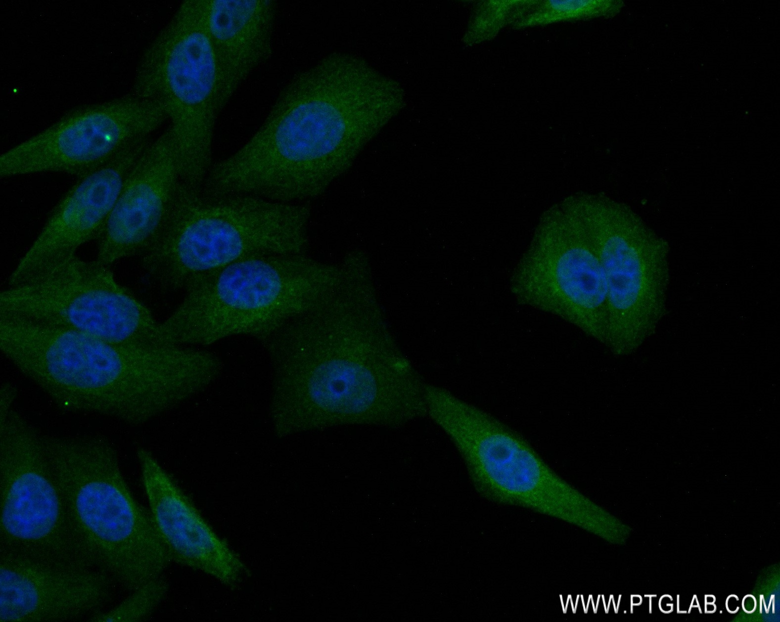IF Staining of HepG2 using 82377-1-RR