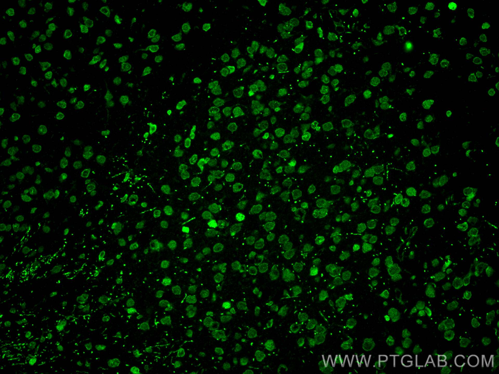 IF Staining of mouse brain using 22008-1-AP