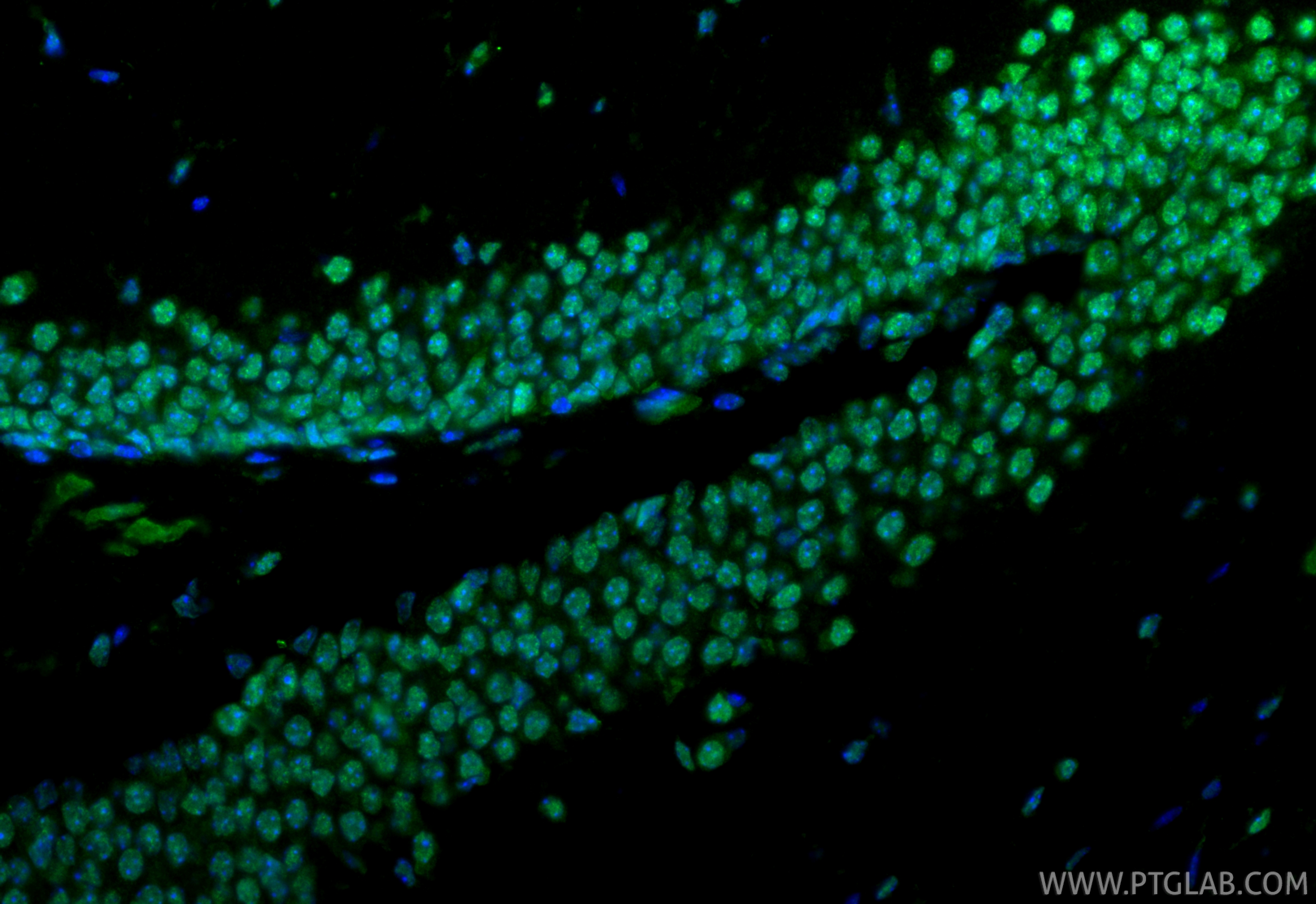 Immunofluorescent analysis of (4% PFA) fixed paraffin-embedded mouse brain tissue using EGR1 antibody (55117-1-AP) at dilution of 1:200 and CoraLite®488-Conjugated Goat Anti-Rabbit IgG(H+L) (<a class='green' href='/productredirect?CatalogNo=SA00013-2' target='_blank'>SA00013-2</a>). Heat mediated antigen retrieval with Tris-EDTA buffer (pH 9.0). IF Staining of mouse brain using 55117-1-AP
