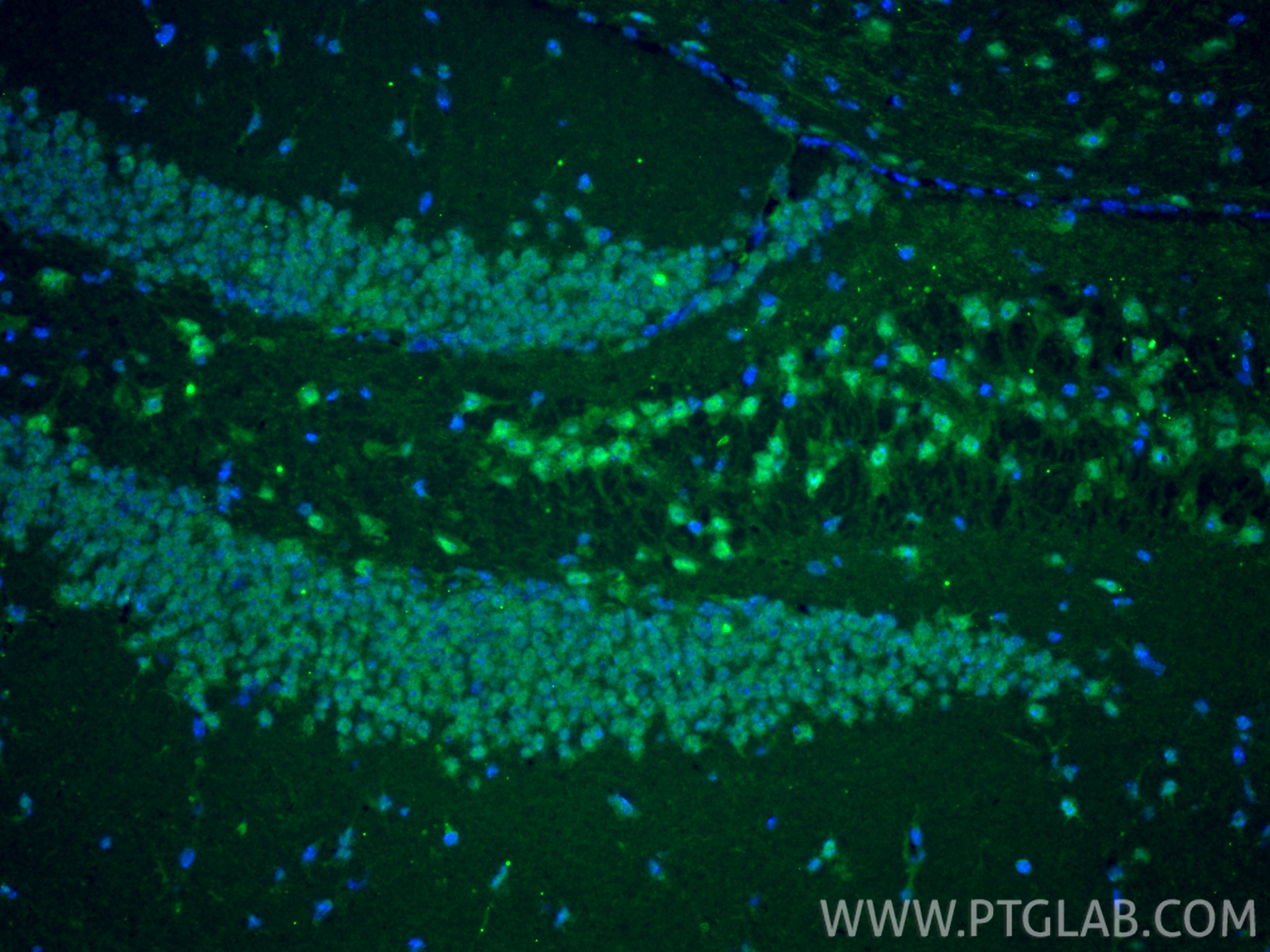 Immunofluorescent analysis of (4% PFA) fixed paraffin-embedded mouse brain tissue using EGR2 antibody (13491-1-AP) at dilution of 1:400 and CoraLite®488-Conjugated Goat Anti-Rabbit IgG(H+L) (<a class='green' href='/productredirect?CatalogNo=SA00013-2' target='_blank'>SA00013-2</a>). Heat mediated antigen retrieval with Tris-EDTA buffer (pH 9.0). IF Staining of mouse brain using 13491-1-AP
