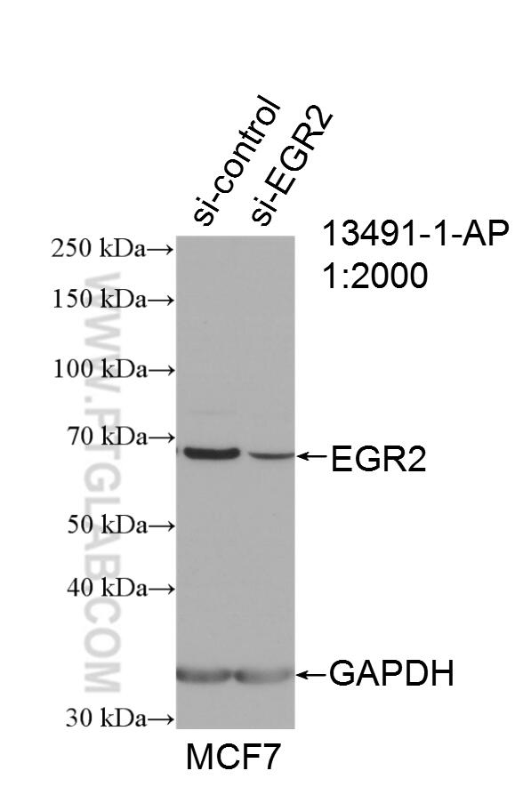 WB analysis of MCF-7 using 13491-1-AP