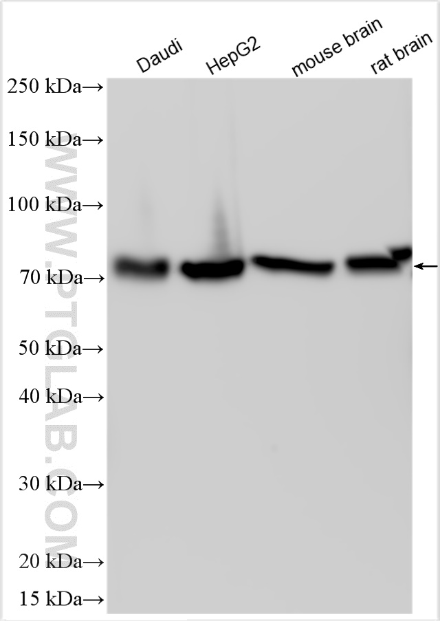 WB analysis using 13491-1-AP