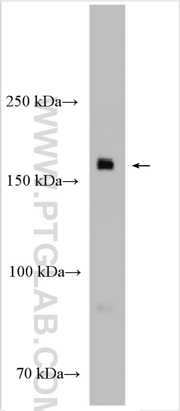 rat testis tissue were subjected to SDS PAGE followed by western blot with 29383-1-AP (EHBP1L1 antibody) at dilution of 1:1000 incubated at room temperature for 1.5 hours. WB analysis of rat testis using 29383-1-AP