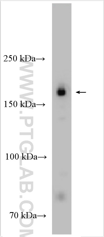 mouse testis tissue were subjected to SDS PAGE followed by western blot with 29383-1-AP (EHBP1L1 antibody) at dilution of 1:1000 incubated at room temperature for 1.5 hours. WB analysis of mouse testis using 29383-1-AP