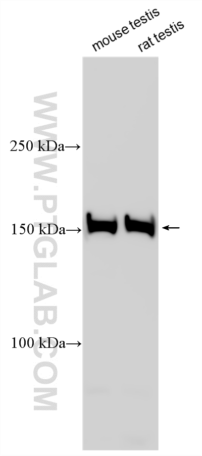 Various lysates were subjected to SDS PAGE followed by western blot with 29383-1-AP (EHBP1L1 antibody) at dilution of 1:3000 incubated at room temperature for 1.5 hours. WB analysis using 29383-1-AP