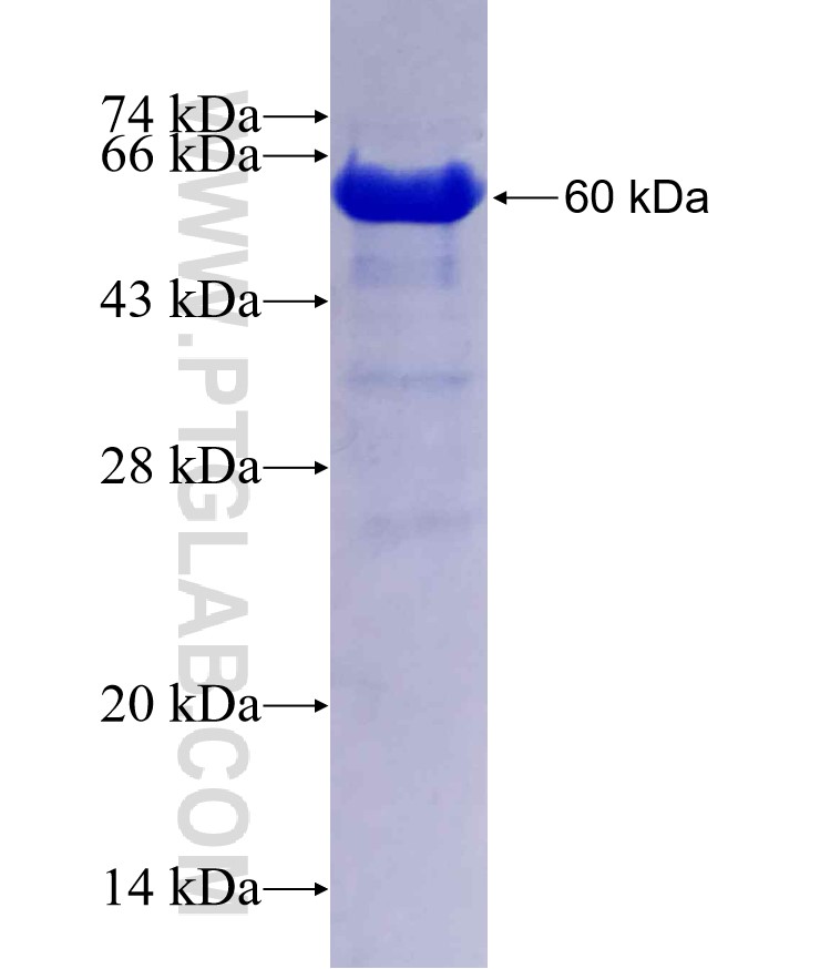 EHBP1L1 fusion protein Ag29796 SDS-PAGE EHBP1L1 fusion protein Ag29796 SDS-PAGE