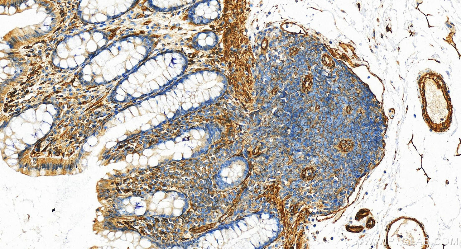 IHC staining of human colon using 11440-1-AP