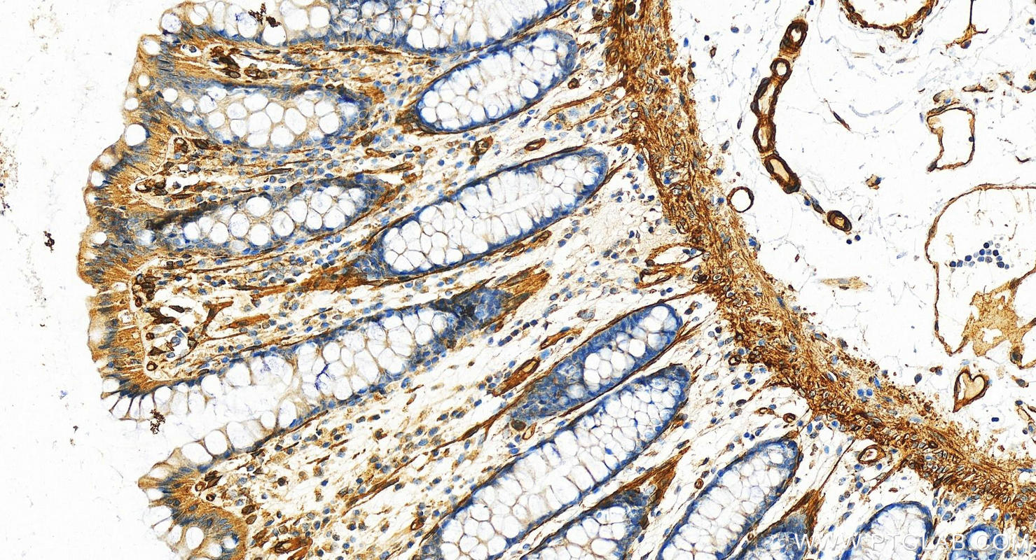 IHC staining of human colon using 11440-1-AP