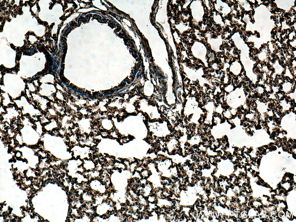 IHC staining of mouse lung using 25320-1-AP