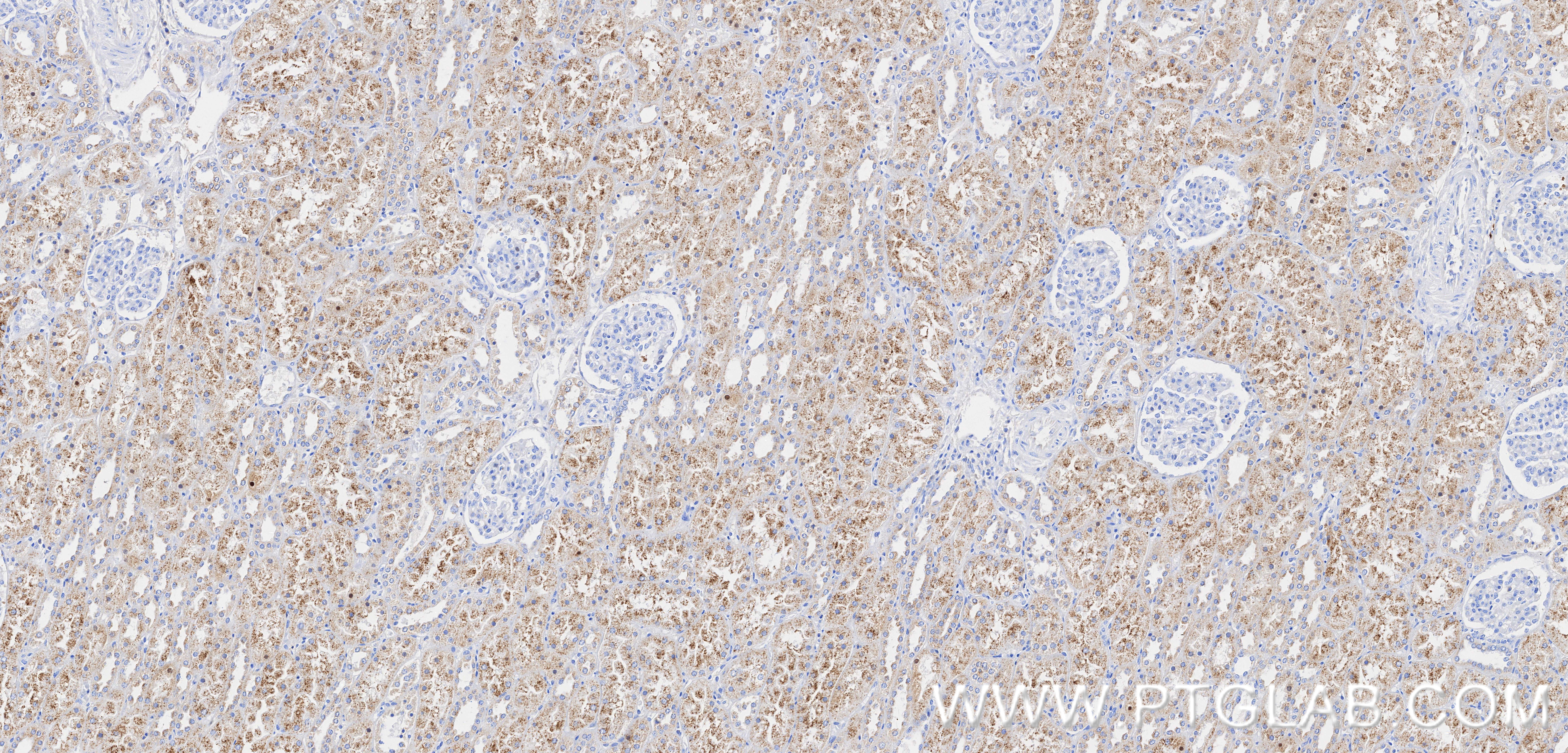 Immunohistochemical analysis of paraffin-embedded human kidney tissue slide using 87579-1-RR (EHHADH antibody) at dilution of 1:1000 (under 10x lens). Heat mediated antigen retrieval with Tris-EDTA buffer (pH 9.0). IHC staining of human kidney using 87579-1-RR