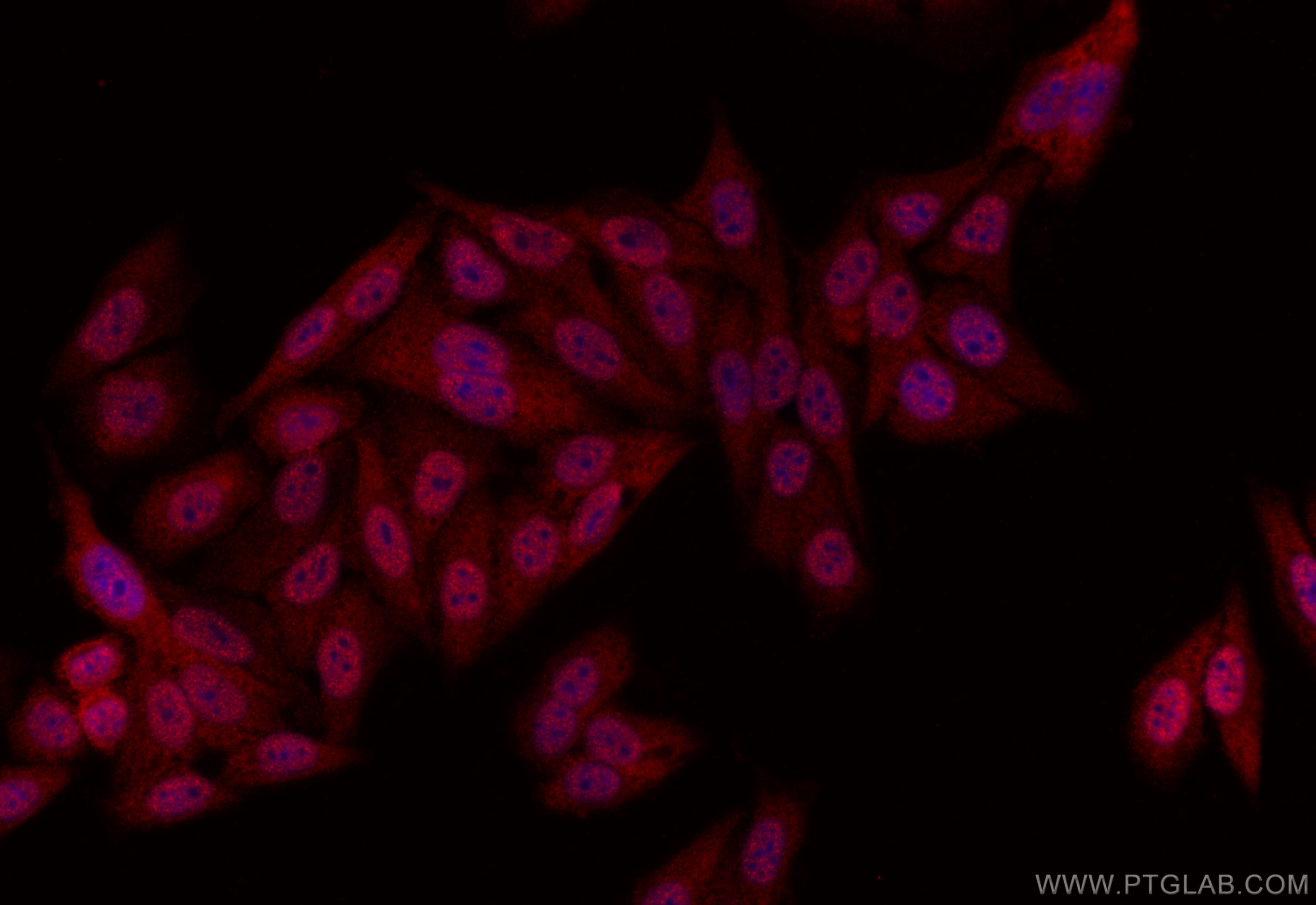 IF Staining of HepG2 using 11734-1-AP